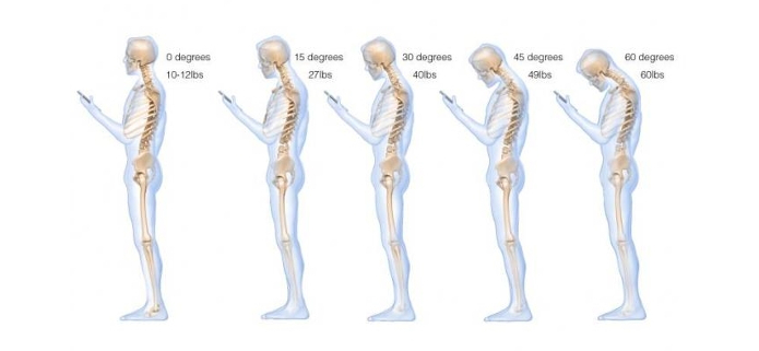 Shoulder Pain Mobile Phone Use Chiropractor