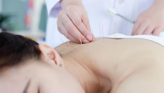 Acupuncture Clinic in West Sussex